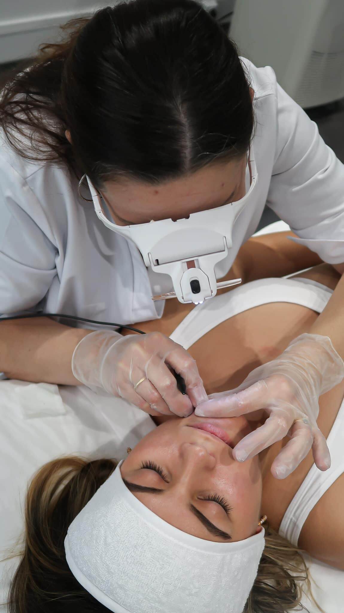 electroepilation